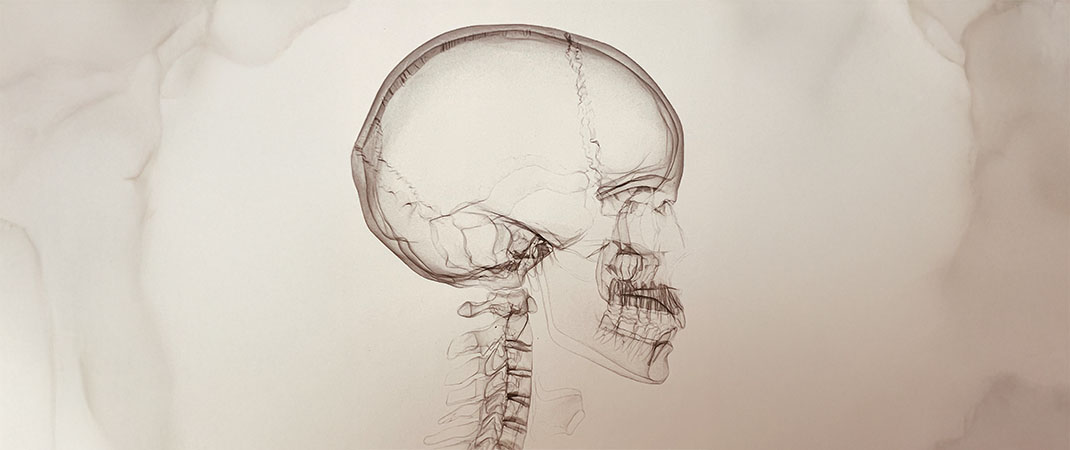 Probleme mit dem Kiefergelenk?